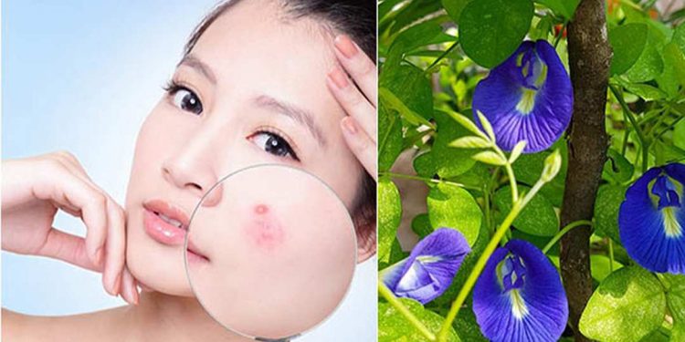 Công dụng làm đẹp của hoa đậu biếc trong việc giảm nhăn, làm mờ sẹo